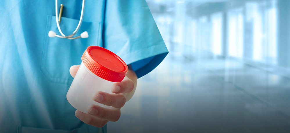 UTI Symptoms? Make sure with a UTI Test
